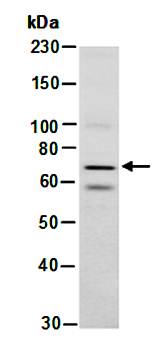 WHSC1 isoform 3 antibody