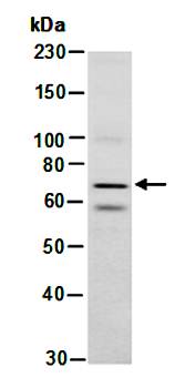WHSC1 isoform3 (N) Antibody, Rabbit Polyclonal