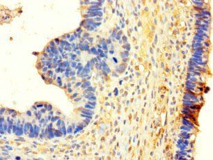 WHSC1L1 Antibody