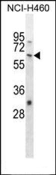 WHSC2 antibody