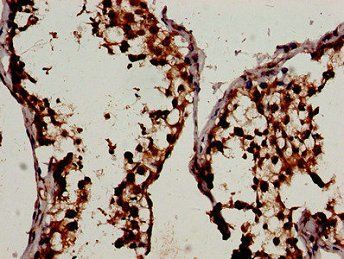 WIF1 Antibody