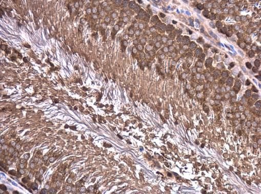 Wilms Tumor 1 antibody