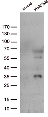 Wilms Tumor Protein (WT1) antibody