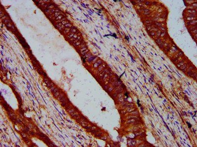 WIPF2 Antibody
