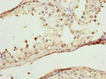 WIPI2 Antibody