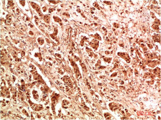 WIPI2 Antibody