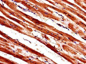 WISP1 Antibody