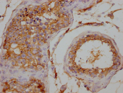 WISP2 Antibody