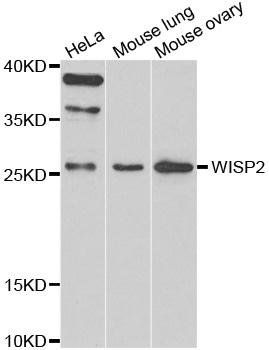 WISP2 antibody