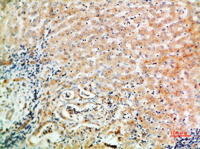 WISP3 antibody