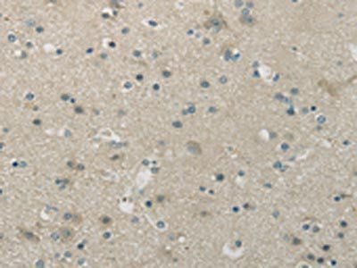 WNK1 Antibody