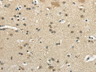 WNK2 Antibody