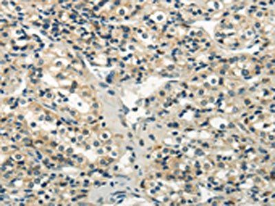 WNK2 Antibody