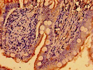 WNK2 Antibody