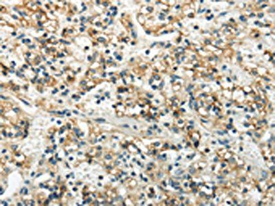 WNK3 Antibody