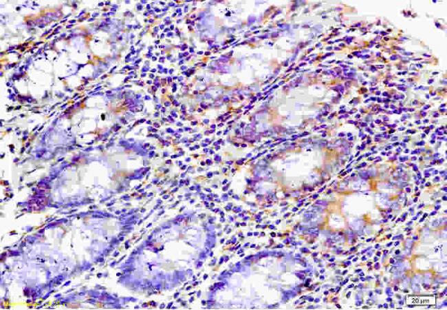 WNK3 Rabbit Polyclonal Antibody