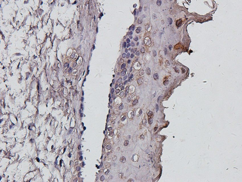 Wnt-5a antibody