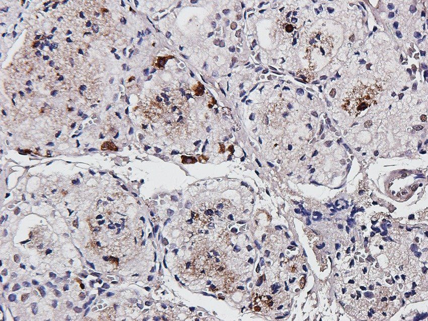 Wnt-5a Rabbit Polyclonal Antibody