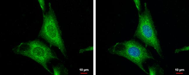 Wnt10a antibody [N1C1-2]