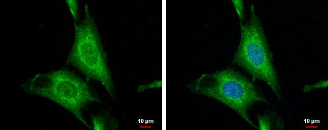 Wnt10a antibody