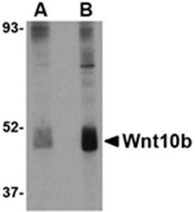 Wnt10b Antibody