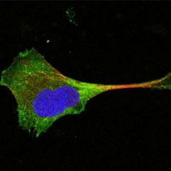 WNT10B Antibody