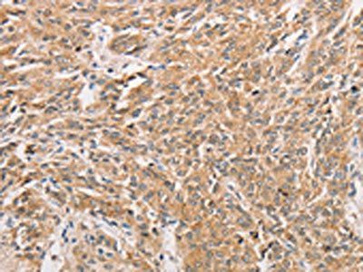 WNT11 Antibody