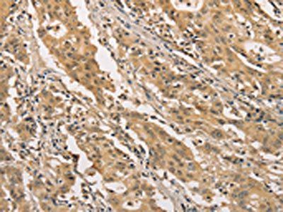 WNT11 Antibody