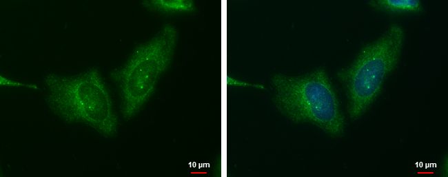 Wnt family member 11 Antibody