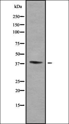 WNT16 antibody
