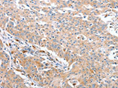 WNT3A Antibody