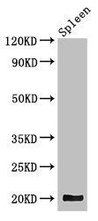 WRB antibody