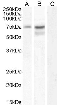 NCDN antibody