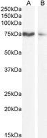 Goat anti-SLCO1B3 Antibody
