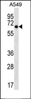 WSCD2 antibody