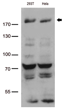 WSTF (BAZ1B) antibody