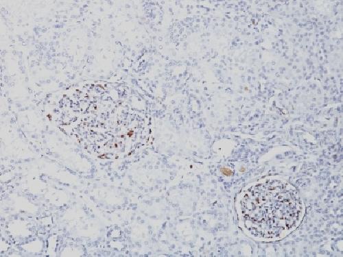 Wilm’s Tumor 1 (WT1) (Wilm’s Tumor & Mesothelial Marker) Antibody