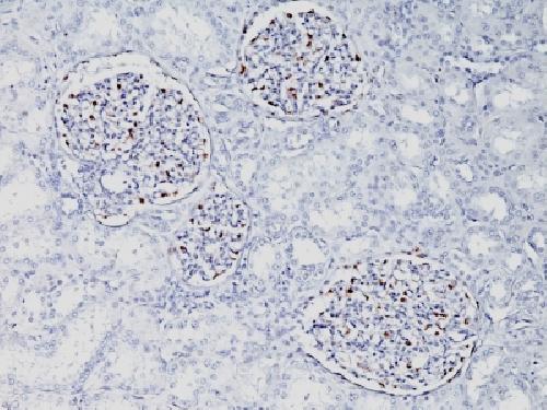 Wilm’s Tumor 1 (WT1) (Wilm’s Tumor & Mesothelial Marker) Antibody