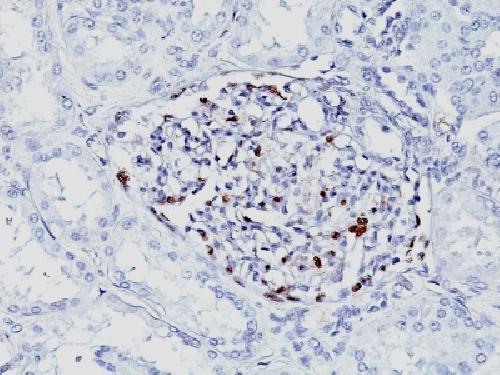 Wilm’s Tumor 1 (WT1) (Wilm’s Tumor & Mesothelial Marker) Antibody