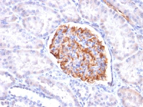 Recombinant Wilm’s Tumor 1 (WT1) (Wilm’s Tumor & Mesothelial Marker) Antibody