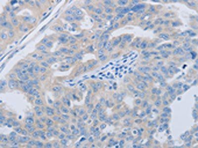 PAWR Antibody