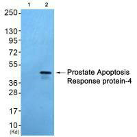 WT1 antibody