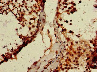 WTAP Antibody