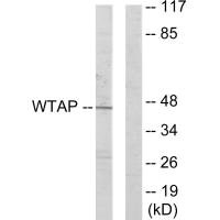WTAP antibody