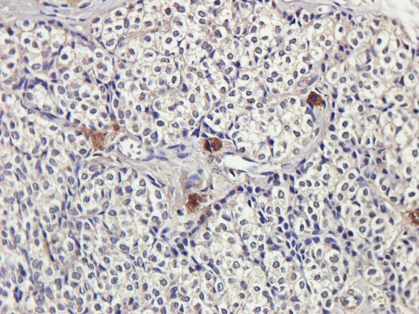 WWTR1 antibody