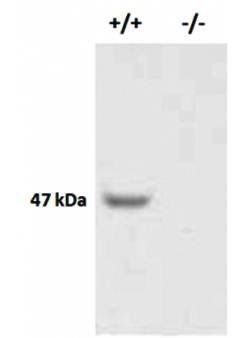 X-linked interleukin-1 receptor Chicken Polyclonal Antibody