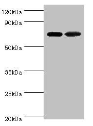 X-ray repair cross-complementing protein 6 antibody