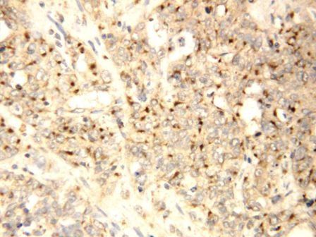 Anti-XIAP-associated factor 1 XAF1 Antibody