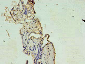 XAGE1A antibody