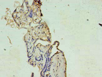 XAGE1A Antibody